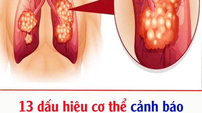 13 dấu hiệu cơ thể cảnh báo đang trong giai đoạn đầu của ung thư trước 2-5 năm 13 dấu hiệu cơ thể cảnh báo đang trong giai đoạn đầu của ung thư trước 2-5 năm