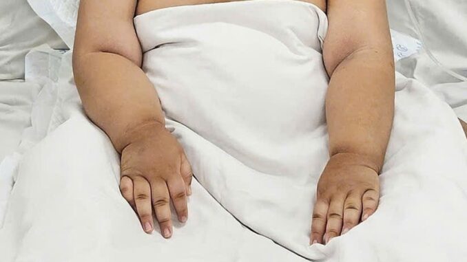Bé 4 tuổi suýt qua đời vì nhiễm cúm A Bé 4 tuổi suýt qua đời vì nhiễm cúm A