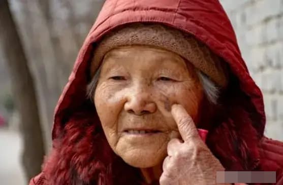 Vì sao người già thường có nhiều đốm trên cơ thể? Nhắc nhở: Tránh xa 3 thói quen sau tuổi 50 có thể làm giảm đồi mồi Vì sao người già thường có nhiều đốm trên cơ thể? Nhắc nhở: Tránh xa 3 thói quen sau tuổi 50 có thể làm giảm đồi mồi