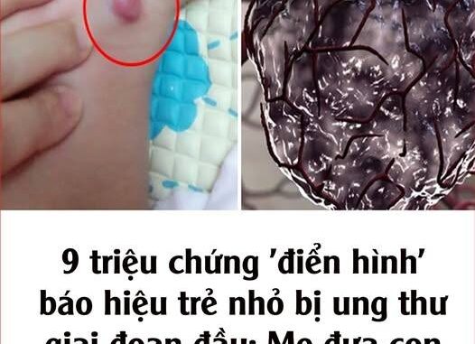 9 triệu chứng ‘điển hình’ báo hiệu trẻ nhỏ bị ung thư giai đoạn đầu: Mẹ đưa con đến viện ngay 9 triệu chứng ‘điển hình’ báo hiệu trẻ nhỏ bị ung thư giai đoạn đầu: Mẹ đưa con đến viện ngay