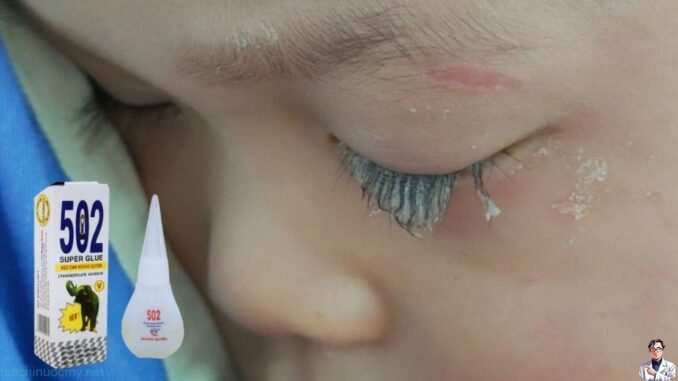 Bé trai 3 tuổi bị keo 502 bắn vào mắt, hành động của người mẹ trong “30 giây vàng” đã cứu con khỏi cảnh mù loà! Bé trai 3 tuổi bị keo 502 bắn vào mắt, hành động của người mẹ trong “30 giây vàng” đã cứu con khỏi cảnh mù loà!