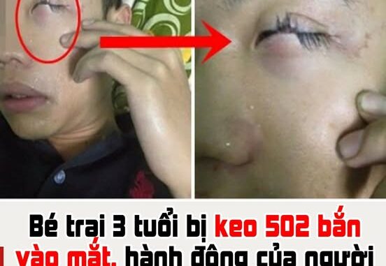 Bé trai 3 tuổi bị keo 502 bắn vào mắt, hành động của người mẹ trong “30 giây vàng” đã cứu con khỏi cảnh mù loà! Bé trai 3 tuổi bị keo 502 bắn vào mắt, hành động của người mẹ trong “30 giây vàng” đã cứu con khỏi cảnh mù loà!