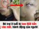 Bé trai 3 tuổi bị keo 502 bắn vào mắt, hành động của người mẹ trong “30 giây vàng” đã cứu con khỏi cảnh mù loà!