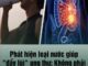 Phát hiện loại nước giúp “đẩy lùi” ung thư: Không phải trà hay cà phê