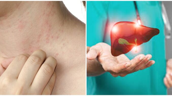 Cơ thể xuất hiện '1 ngứa, 2 đỏ, 2 đau' chứng tỏ gan đang bị tàn phá, nên đi khám sớm Cơ thể xuất hiện '1 ngứa, 2 đỏ, 2 đau' chứng tỏ gan đang bị tàn phá, nên đi khám sớm