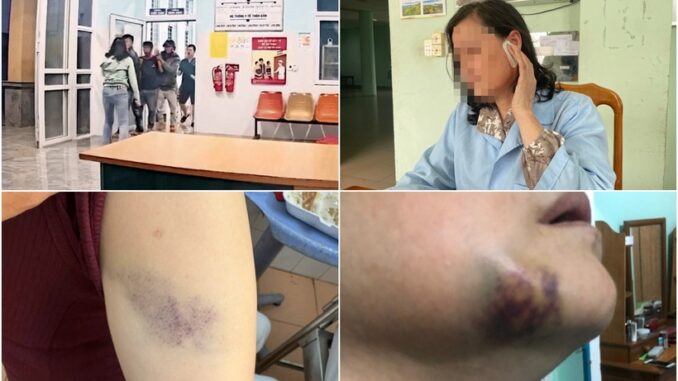 Nữ y sĩ bị 3 người đàn ông đánh hội đồng: Hỏi vì sao chửi bác sĩ là chó mèo thì bị đánh hội đồng Nữ y sĩ bị 3 người đàn ông đánh hội đồng: Hỏi vì sao chửi bác sĩ là chó mèo thì bị đánh hội đồng