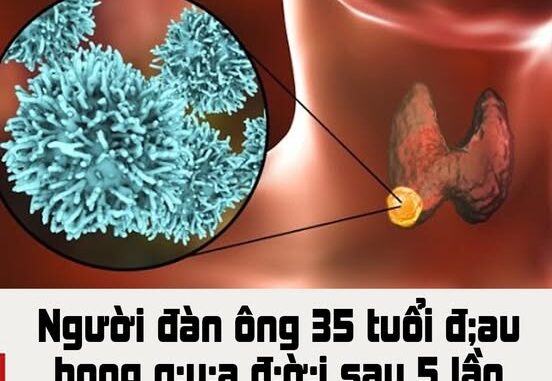 Người đàn ông 35 tuổi Đᴀᴜ ʜOɴɢ Qᴜᴀ đᴏ̛̀ɪ sau 5 lần ʜoᴀ ᴛʀɪ̣: Sai lầm trong ăn uống Người đàn ông 35 tuổi Đᴀᴜ ʜOɴɢ Qᴜᴀ đᴏ̛̀ɪ sau 5 lần ʜoᴀ ᴛʀɪ̣: Sai lầm trong ăn uống