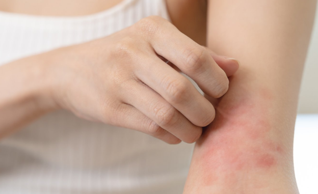 Cơ thể xuất hiện ‘‘1 ngứa, 2 đỏ, 2 đau’’ cho thấy bệnh tật đang ‘‘tàn phá’’ gan, cần thăm khám sớm nhất có thể Cơ thể xuất hiện ‘‘1 ngứa, 2 đỏ, 2 đau’’ cho thấy bệnh tật đang ‘‘tàn phá’’ gan, cần thăm khám sớm nhất có thể