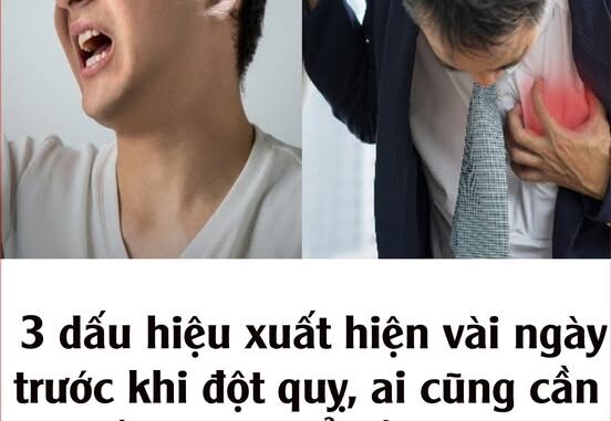 3 dấu hiệu xuất hiện vài ngày trước khi đột quỵ, ai cũng cần nắm được để đề phòng 3 dấu hiệu xuất hiện vài ngày trước khi đột quỵ, ai cũng cần nắm được để đề phòng