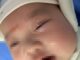 Mẹ cắt móng tay văng vào mắt, cháu bé 2 tháng tuổi lâm nguy