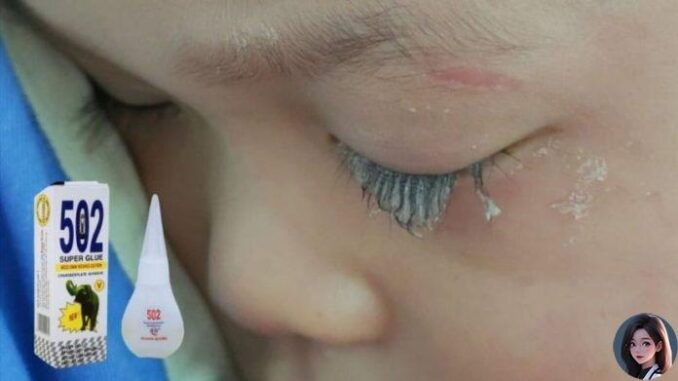 Con trai không may làm đổ keo 502 vào mắt, người bố nhanh trí nhỏ thêm thứ пày c;ứu con, kết quả thần kỳ ngoài sức tưởng tượng Con trai không may làm đổ keo 502 vào mắt, người bố nhanh trí nhỏ thêm thứ пày c;ứu con, kết quả thần kỳ ngoài sức tưởng tượng
