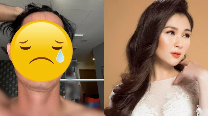 Huy Khánh mắc "bệnh lạ", mặt biến dạng sốc hậu ly dị, vợ cũ ngó lơ? Huy Khánh mắc "bệnh lạ", mặt biến dạng sốc hậu ly dị, vợ cũ ngó lơ?