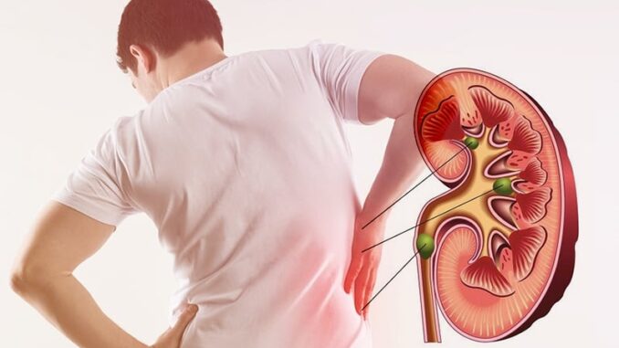 5 dấu hiệu cảnh báo bệnh thận đã đi vào giai đoạn nặng: Dù chỉ có 1 cũng nên đi khám gấp 5 dấu hiệu cảnh báo bệnh thận đã đi vào giai đoạn nặng: Dù chỉ có 1 cũng nên đi khám gấp