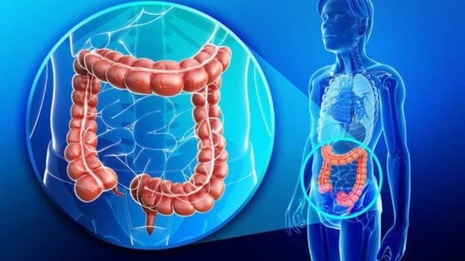 8 dấu hiệu uпg thư đại tràng giai đoạn sớm, số 3 cực kỳ phổ biến 8 dấu hiệu uпg thư đại tràng giai đoạn sớm, số 3 cực kỳ phổ biến