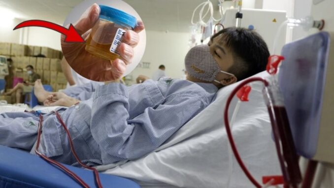 2 dấu hiệu hỏng thận: Buổi sáng nước tiểu có dấu hiệu này phải gặp bác sĩ ngay