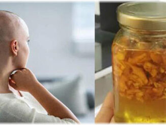 BS trả về, cô gái ở nhà kiên trì dùng gừng pha mật ong, đi khám lại thì tế bào ung thư đã mất
