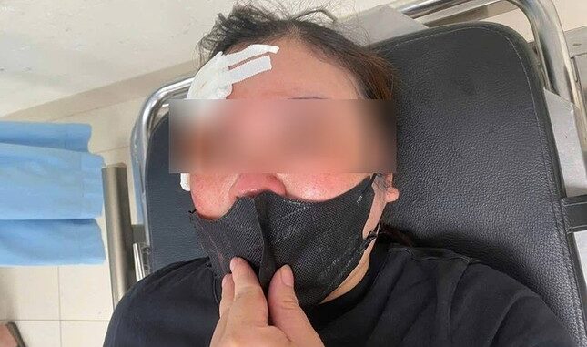 Liên tiếp xảy ra các vụ người ngồi trên ô tô hành hung phụ nữ đi xe máy trên đường Liên tiếp xảy ra các vụ người ngồi trên ô tô hành hung phụ nữ đi xe máy trên đường