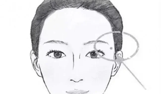 Điểm Mặt 5 Nốt Ruồi "Đế Vương" Càng Già Càng Giàu: Ai Có 1 Trong 5 Cũng Viên Mãn Cả Đời